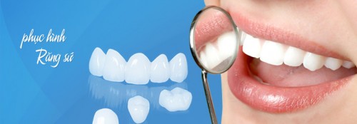 Thời gian bọc răng sứ mất bao lâu ?